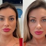 andressa urach