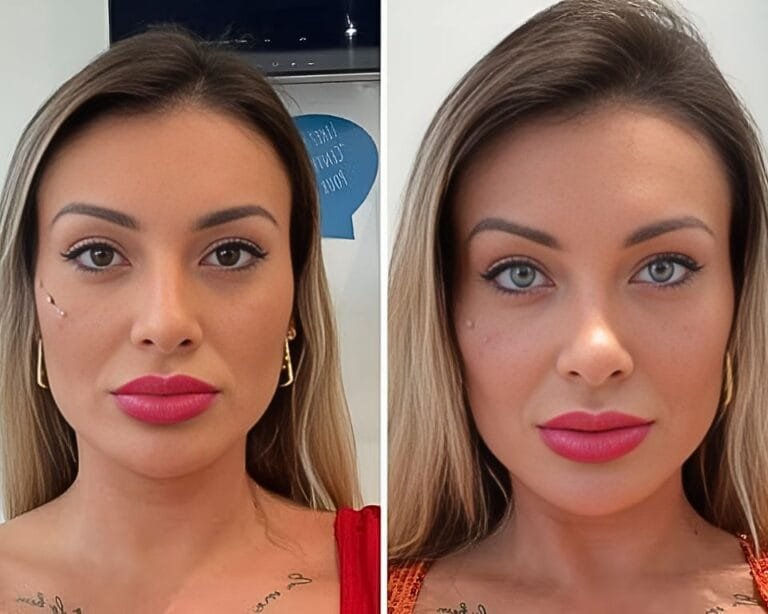 Andressa Urach faz cirurgia para mudar a cor dos olhos